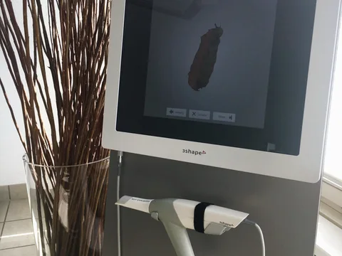 3Shape Trios Scanner mit Monitor für digitale Abformungen